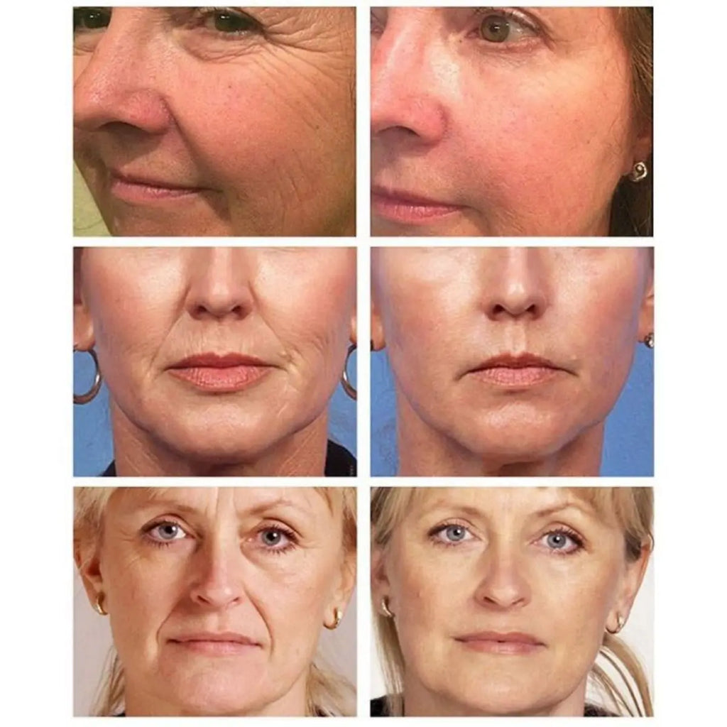Retinol Face Cream Anti-Aging Remove Wrinkle Firming Lifting Whitening Brightening Moisturizing Cream Facial Skin Care TRSTAY Cream Store