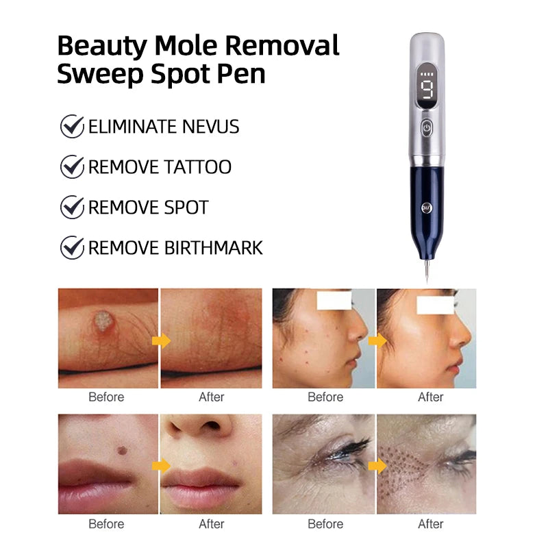Laser Plasma Pen For Mole Dark Spot Freckle Nevus Wart Skin Tag Pimples Tattoo Removal Skin Face Care Beauty Machine Papilloma LESEN Tech Store