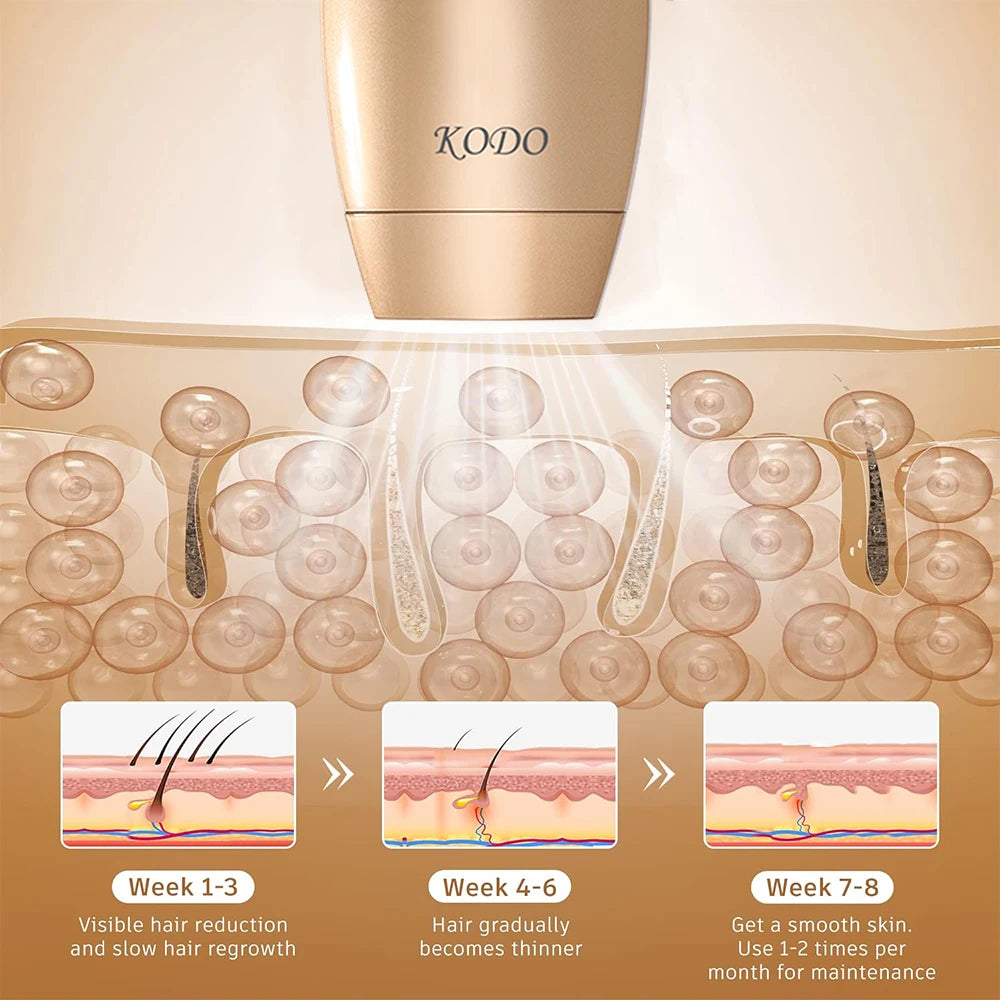 KODO 2026 High-end customization ice Laser Hair removal Laser Epilator Permanent IPL Painless Photoepilator 4 in 1 face and body KODO Official Store