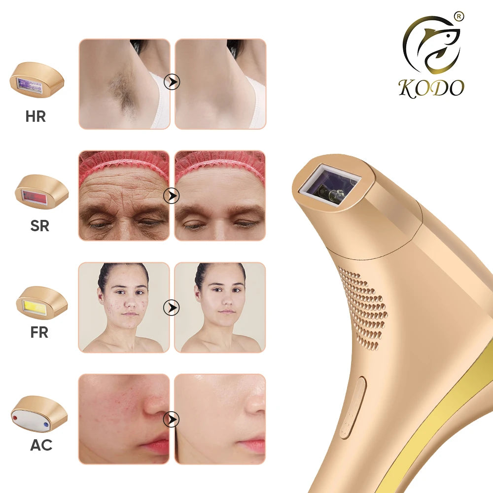 KODO 2026 High-end customization ice Laser Hair removal Laser Epilator Permanent IPL Painless Photoepilator 4 in 1 face and body KODO Official Store